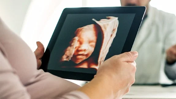 3D and 4D Ultrasounds <strong>3D-4D Sonography</strong>