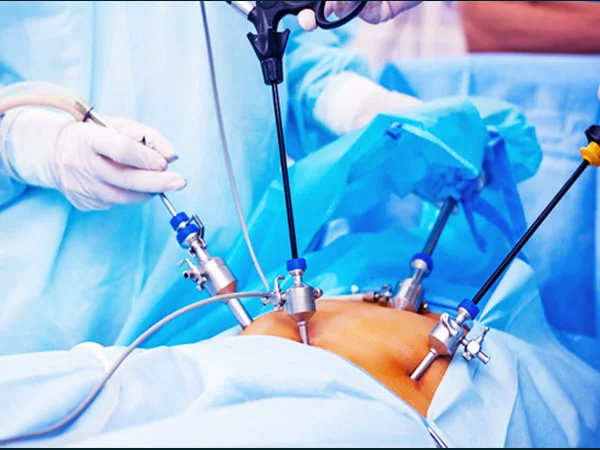 laparoscopic surgery Advanced Laparoscopic Surgeries