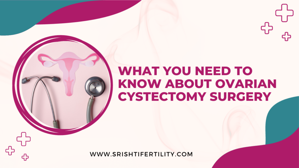 A blog post on Ovarian Cystectomy