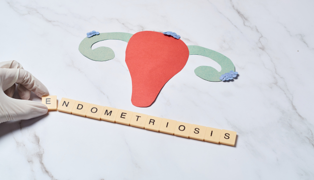 A paper cut like ovary affect with endometriosis