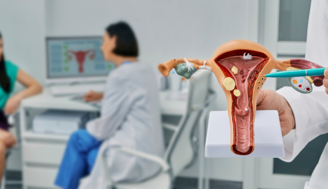 Doctor understanding about ovarian cyst by showing model