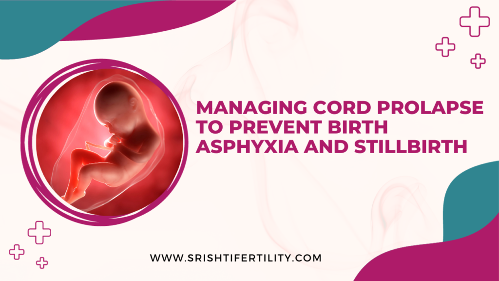 Managing Cord Prolapse