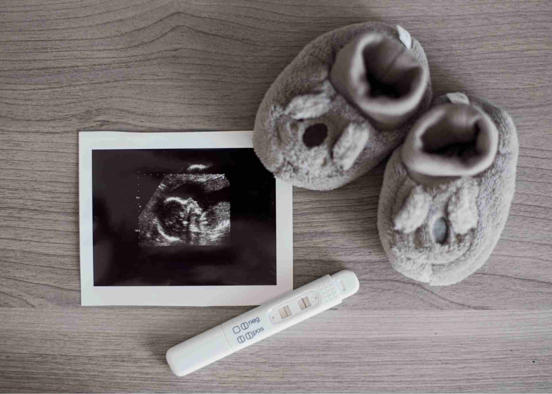 1st Month First Week Pregnancy ke Lakshan Janein 1 1st Month First Week Pregnancy ke Lakshan Janein pregnancy ke lakshan - sonography in jaipur