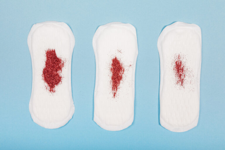 Are Period Blood Clots Normal? Causes, Large Clots & When to Worry 